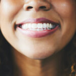 Closeup of a Black woman smiling after cosmetic dentistry