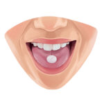 Graphic illustration of patient utilizing dental sedation for dental anxiety in the form of oral conscious sedation.
